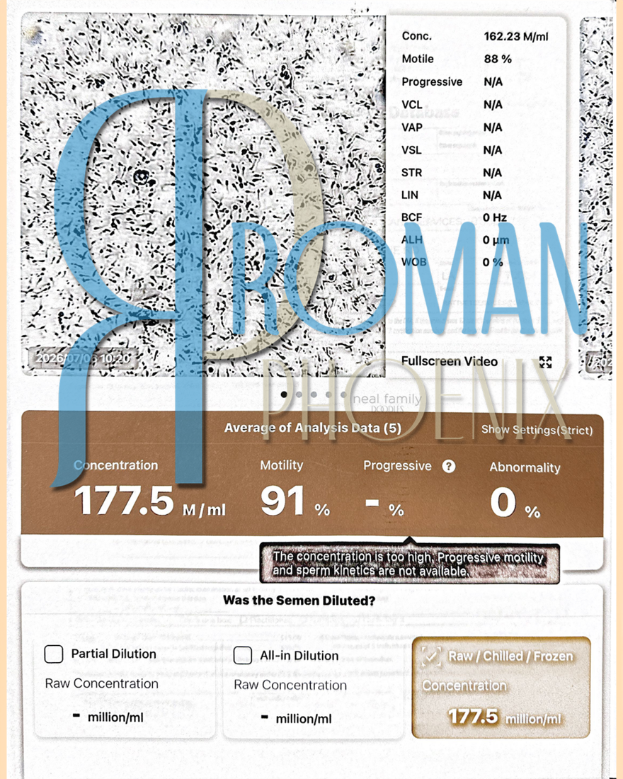 Semen Analysis 7/06/2026